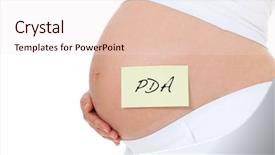  Presentation with pregnant woman - Presentation theme having baby anesthesia - pregnant woman with post-it note background and a lemonade colored foreground