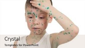  Presentation with sick child - Colorful PPT theme enhanced with baby poor - sick child chickenpox isolated backdrop and a  colored foreground