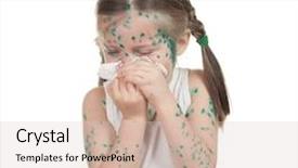  Presentation with sick child - Cool new PPT layouts with baby poor - sick child chickenpox isolated backdrop and a  colored foreground
