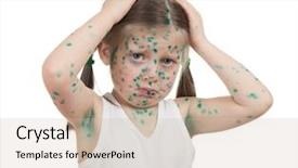  Presentation with sick child - Beautiful PPT layouts featuring baby poor - sick child chickenpox isolated backdrop and a  colored foreground