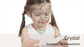  Presentation with sick child - Audience pleasing slide deck consisting of baby poor - sick child chickenpox isolated backdrop and a  colored foreground