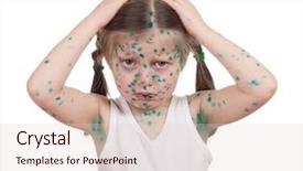  Presentation with sick child - Presentation design having baby poor - sick child chickenpox isolated background and a  colored foreground