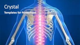  Presentation with backache - Colorful slide set enhanced with backache illustration backdrop and a ocean colored foreground