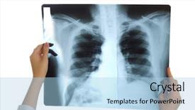 Presentation with cancer - Presentation theme with background cancer - doctor looking at x-ray image background and a light blue colored foreground