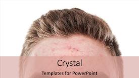 Presentation with acne - Amazing presentation having bacteria - forehead with acne backdrop and a coral colored foreground