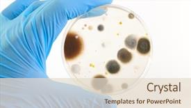  Presentation with petri dish - Presentation with bacteria - hand in blue glove holds background and a lemonade colored foreground