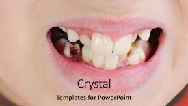  Presentation with odontology teeth mold - Colorful PPT theme enhanced with bad teeth closeup backdrop and a lemonade colored foreground