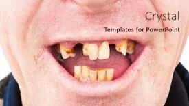  Presentation with bad - Slide deck enhanced with bad-teeth-smoker-missing background and a lemonade colored foreground