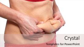  Presentation with patients and weight loss - Presentation design enhanced with bariatric - woman fat belly overweight background and a soft green colored foreground