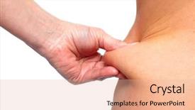  Presentation with weight loss - Slides enhanced with bariatric - woman fat waist overweight background and a lemonade colored foreground