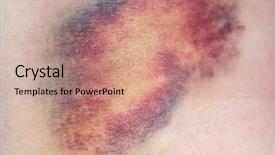  Presentation with photo - Audience pleasing theme consisting of beaten - bruise close-up photo backdrop and a coral colored foreground