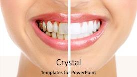  Presentation with health - Theme with beautiful smile dental health whitening background and a coral colored foreground