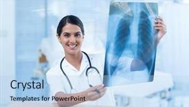  Presentation with xray - Colorful presentation enhanced with beautiful smiling doctor analyzing xray in hospital room backdrop and a light blue colored foreground