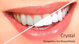  Presentation with teeth whitening - Cool new slide deck with beautiful young woman teeth whitening backdrop and a coral colored foreground