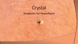  Presentation with bee - PPT theme enhanced with snow covered winter bridge road background and a light gray colored foreground