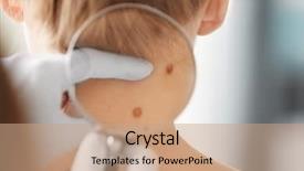  Presentation with patient - Presentation theme with birthmark of patient closeup cancer background and a coral colored foreground