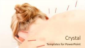  Presentation with acupuncture - Beautiful PPT layouts featuring bladder - female acupuncture patient showing good backdrop and a lemonade colored foreground