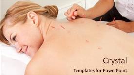  Presentation with needles - Presentation theme having bladder - female acupuncturist stimulating needles background and a lemonade colored foreground