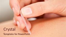  Presentation with acupuncture - Slide set featuring bladder - macro detail of female hand background and a coral colored foreground