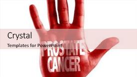  Presentation with bladder - Beautiful slide deck featuring bladder - prostate cancer written on hand backdrop and a lemonade colored foreground