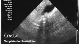  Presentation with acoustic - Colorful theme enhanced with bladder - ultrasound of gallbladder with gallstones backdrop and a dark gray colored foreground