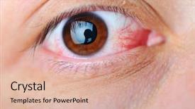  Presentation with illness - Amazing presentation theme having blood drop - illness backdrop and a lemonade colored foreground