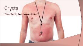  Presentation with sunscreen - Theme with blotchy-sunburn-from-poor-sunscreen background and a lemonade colored foreground