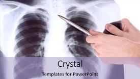  Presentation with chest - Amazing PPT layouts having blue lungs - x-ray image of chest isolated backdrop and a light blue colored foreground