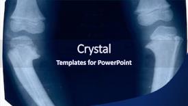  Presentation with color - Presentation theme with scan x ray body human - deformed lower extremity in blue background and a navy blue colored foreground