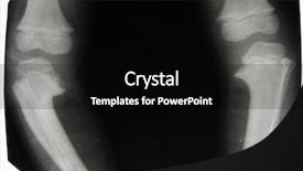  Presentation with lower extremity cast - Amazing theme having disease prognosis - deformed lower extremity in real backdrop and a black colored foreground