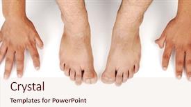  Presentation with human foot - Audience pleasing PPT theme consisting of feet abnormalities - human hands and foot abnormal backdrop and a lemonade colored foreground