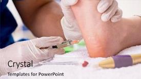  Presentation with feet - Colorful slide set enhanced with body infected - podiatrist treating feet during procedure backdrop and a lemonade colored foreground