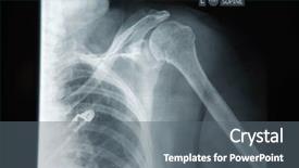  Presentation with review - Theme with film review - doctor examins an x-ray background and a gray colored foreground