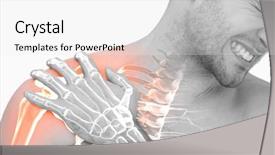  Presentation with shoulder pain - Cool new slide deck with bone disorders - digital composite of highlighted shoulder backdrop and a white colored foreground