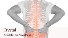  Presentation with back pain - Theme consisting of bone disorders - digital composite of highlighted spine background and a lemonade colored foreground