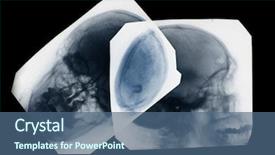  Presentation with human colon anatomy 3d - Cool new slides with bone disorders - photo of side and frontal backdrop and a ocean colored foreground