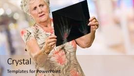  Presentation with fracture bone - PPT theme having bone fracture - senior woman holding x ray background and a coral colored foreground
