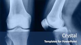  Presentation with joints - Beautiful presentation theme featuring bone fracture - x-ray picture showing knee joints backdrop and a ocean colored foreground