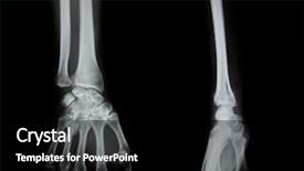  Presentation with human - PPT theme featuring both human arms and hand background and a black colored foreground