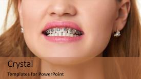  Presentation with teeth - Colorful PPT theme enhanced with braces on teeth beautiful woman backdrop and a coral colored foreground