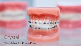  Presentation with jaw - PPT theme featuring braces-on-teeth-lower background and a coral colored foreground
