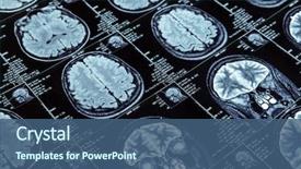  Presentation with imaging - Beautiful PPT layouts featuring brain - magnetic resonance imaging backdrop and a ocean colored foreground