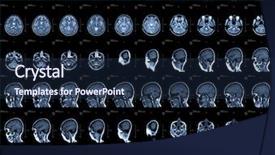  Presentation with brain injury - PPT theme having brain and head mri background and a navy blue colored foreground