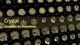  Presentation with head injury - Slide deck consisting of brain and head mri background and a tawny brown colored foreground