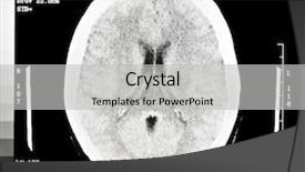  Presentation with xray - Cool new PPT theme with brain ct scan backdrop and a light gray colored foreground