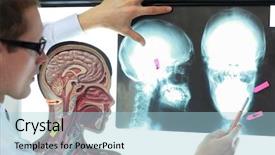  Presentation with human brain - Slide deck with brain injury - specialist with human model watching background and a light blue colored foreground