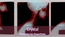  Presentation with brain injury - PPT theme enhanced with brain injury - x-ray image of a human background and a tawny brown colored foreground