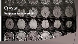  Presentation with brain mri - Amazing slide deck having brain-mri-of-an-adult backdrop and a dark gray colored foreground