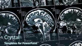  Presentation with mri brain - Audience pleasing PPT theme consisting of brain-mri-of-an-adult backdrop and a tawny brown colored foreground