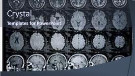 Presentation with brain mri - Slide deck enhanced with brain-mri-of-an-adult background and a tawny brown colored foreground